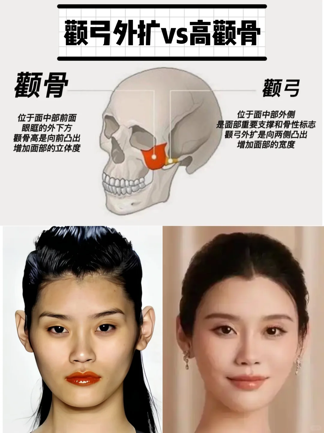 明明都是高颧骨,为什么有的人看起来高级有气质,有的人却外轮廓不