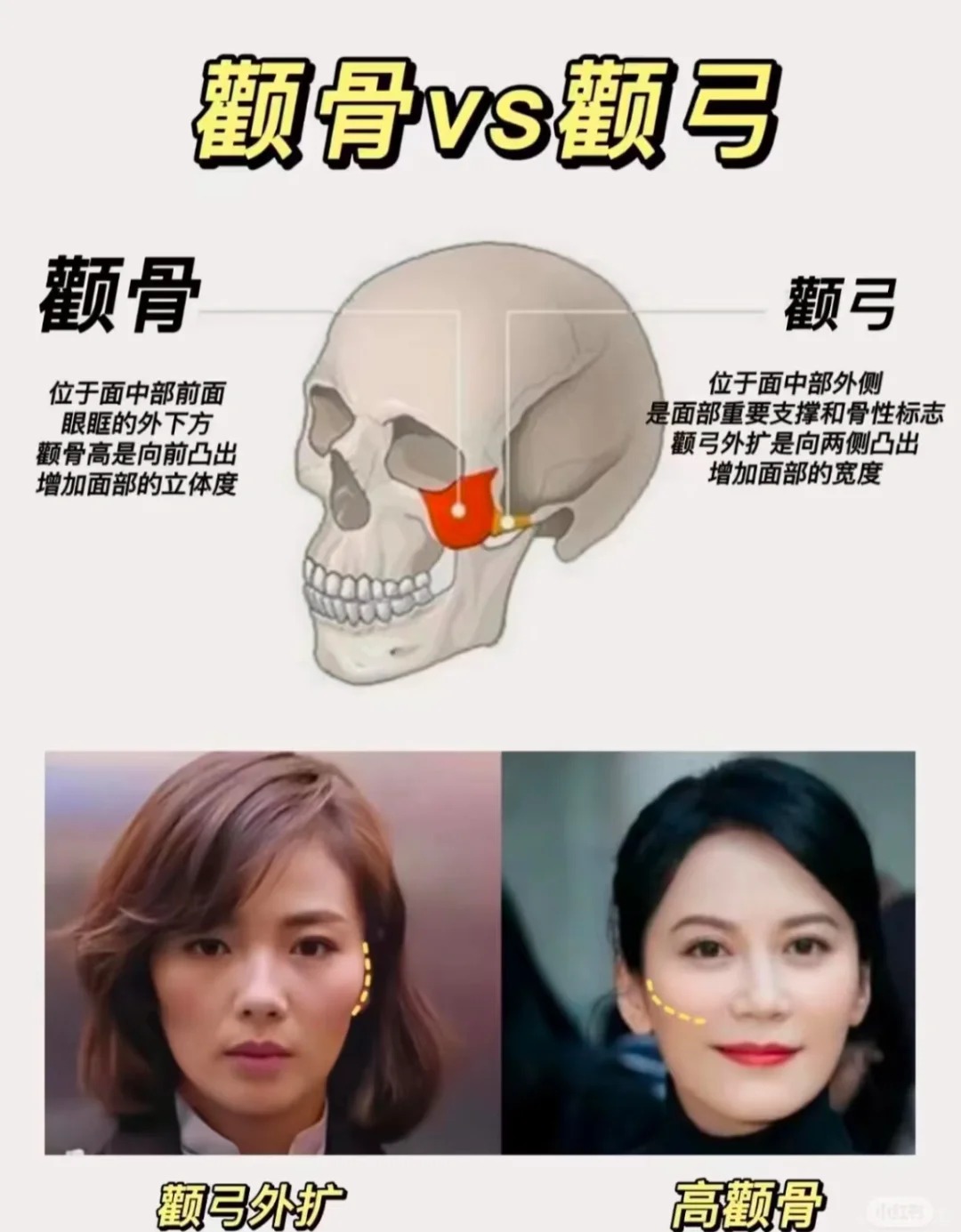 高颧骨的注意了
