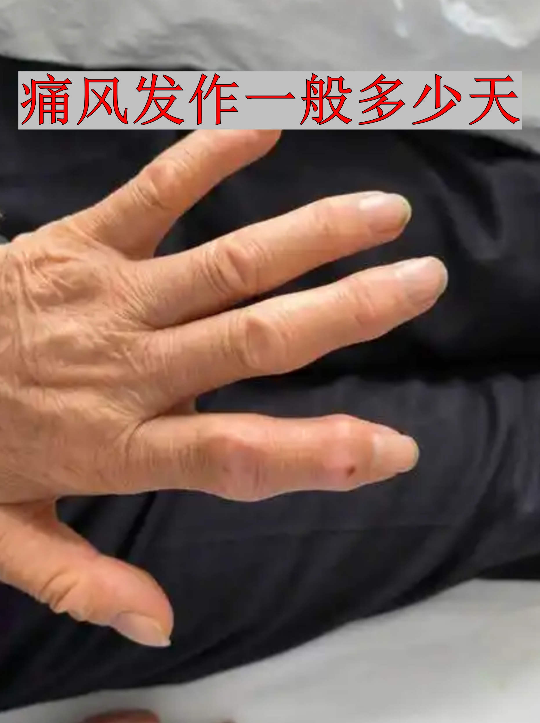 这个问题困扰着不少患者