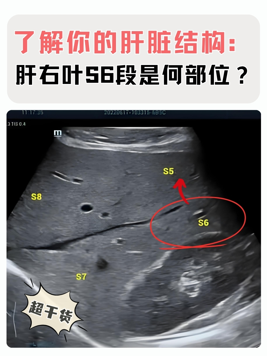 了解你的肝脏结构:肝右叶s6段是何部位?