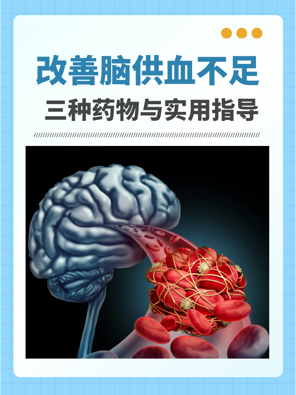一,三种治疗脑供血不足的药物 血管扩张剂:如尼莫地平等,这些药物