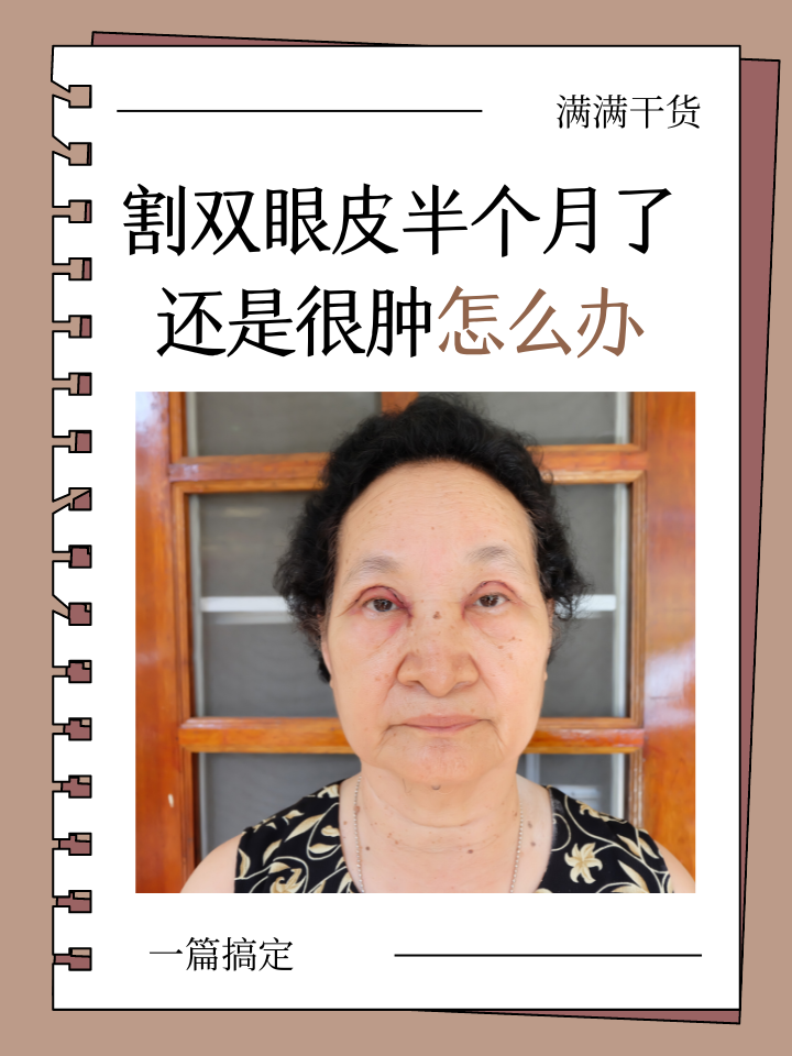 为什么割了双眼皮眼睛还是很小