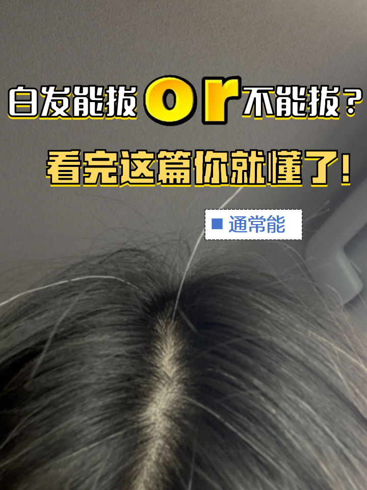 头发为什么会白