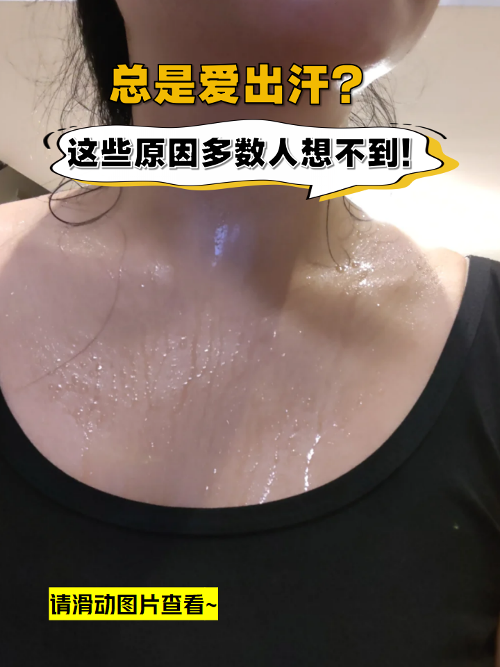 盗汗是身上出汗还是头出汗为什么在线
