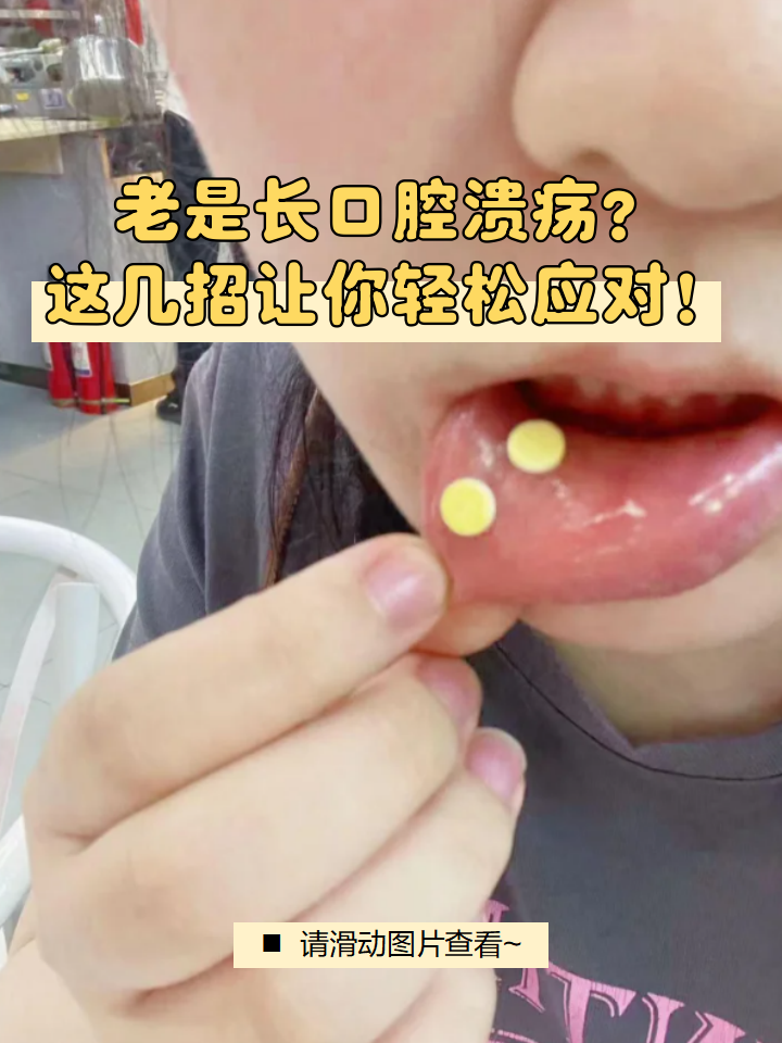 为什么老是长口腔溃疡反反复复为什么在线 为什么老是长口腔溃疡反反复复为什么在线