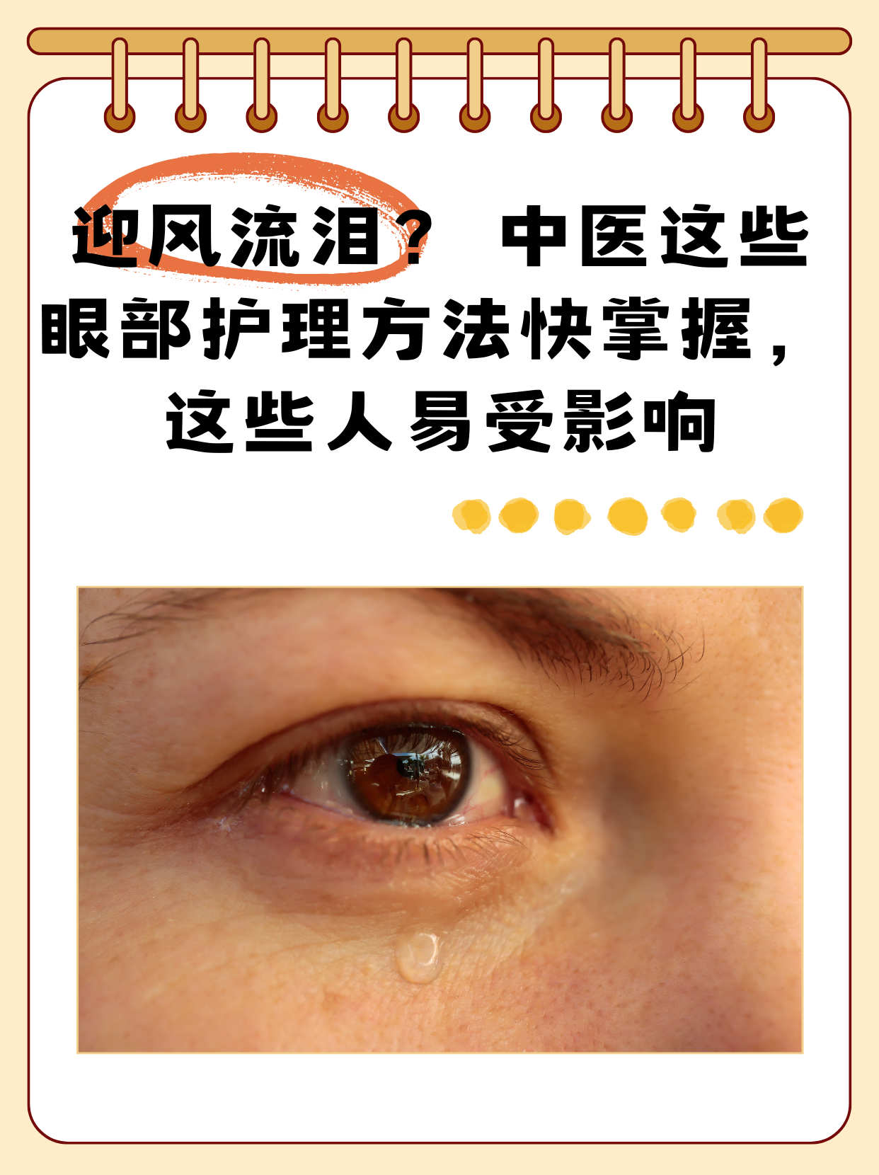 眼睛为什么会得结膜炎