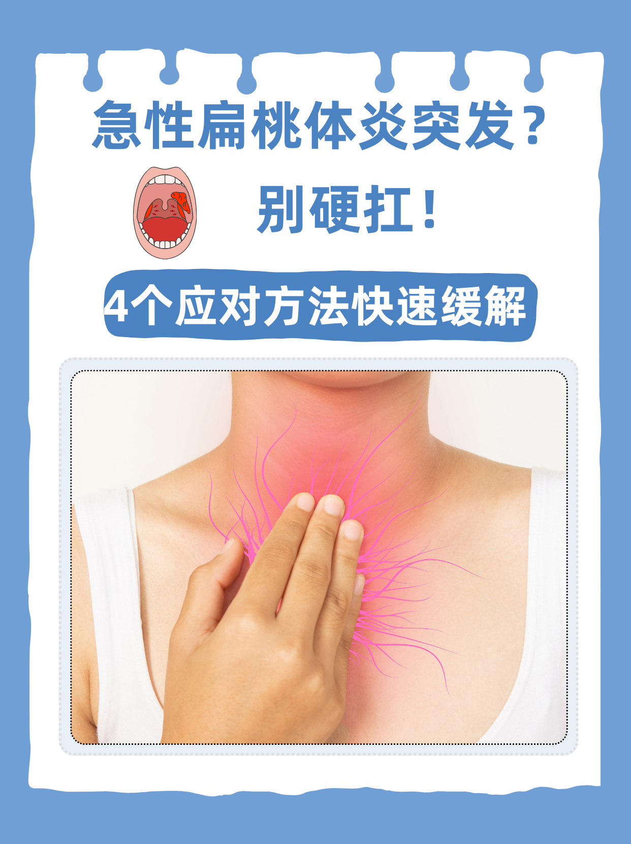  疫情期间喉咙发炎了怎么办(喉咙发炎和正常对比照)