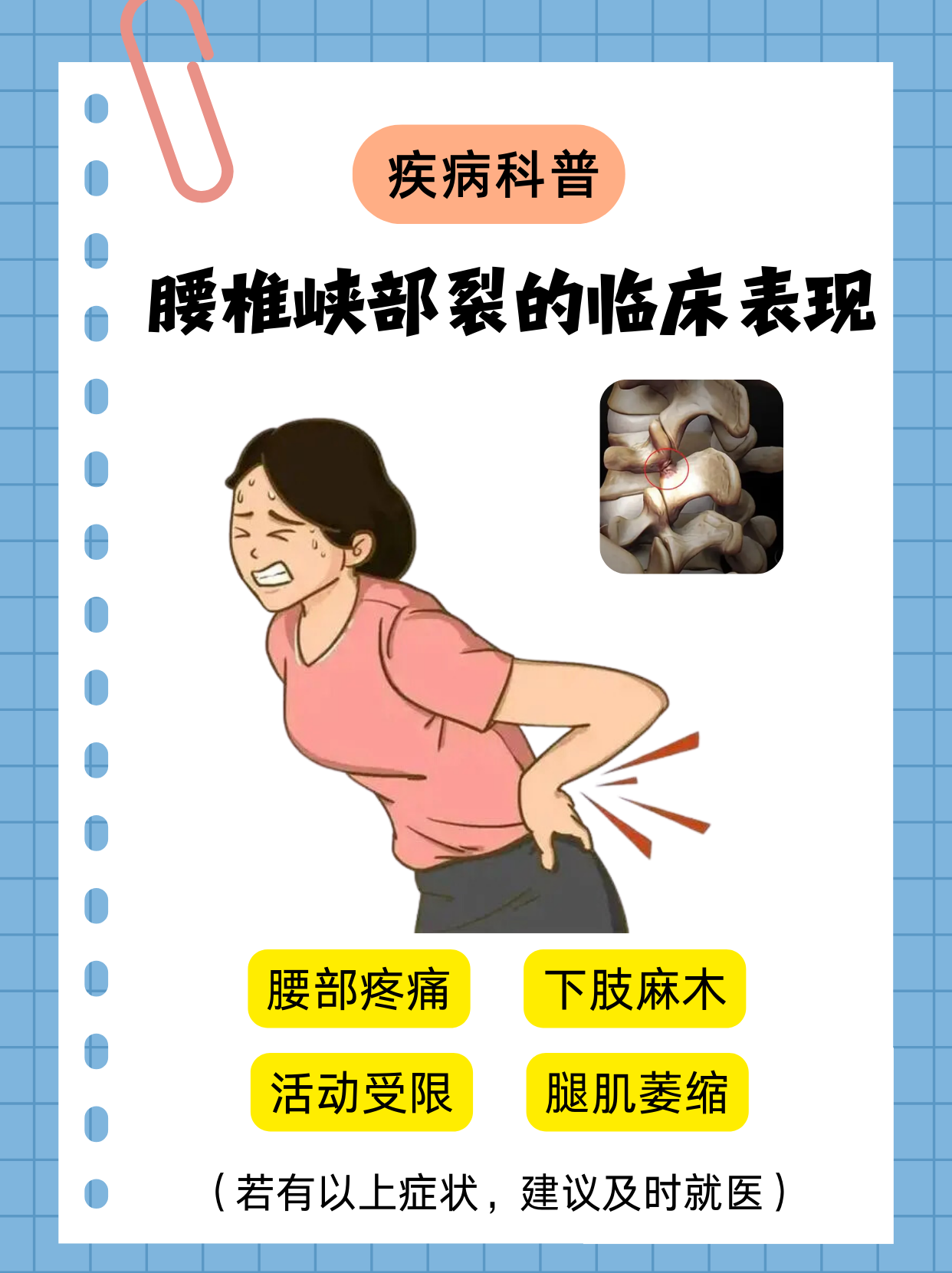 导致局部承重异逞迪坎苛严坎苛 脊柱裂为什么后腰有毛脊柱裂的症状