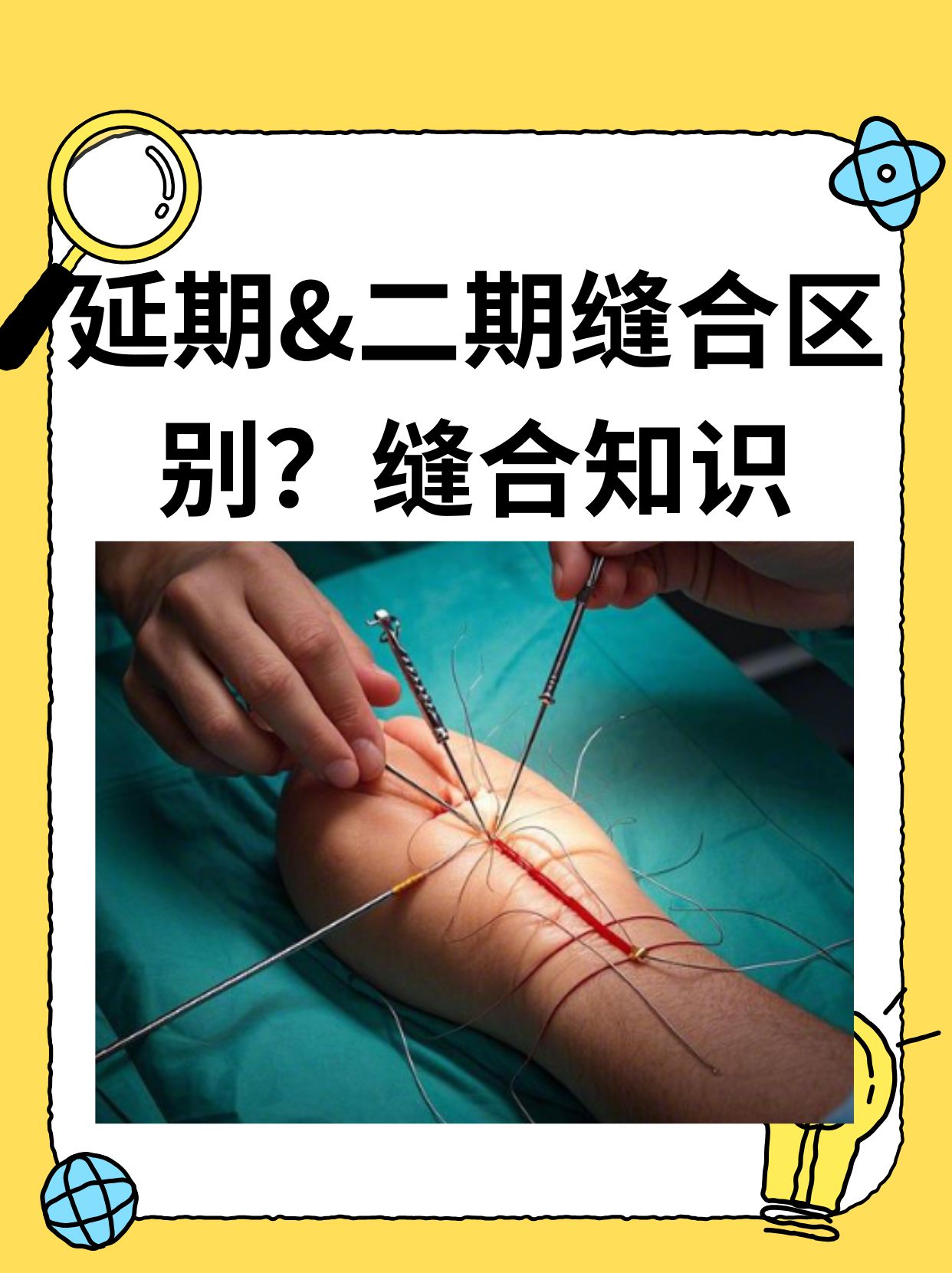 延期&二期缝合区别?