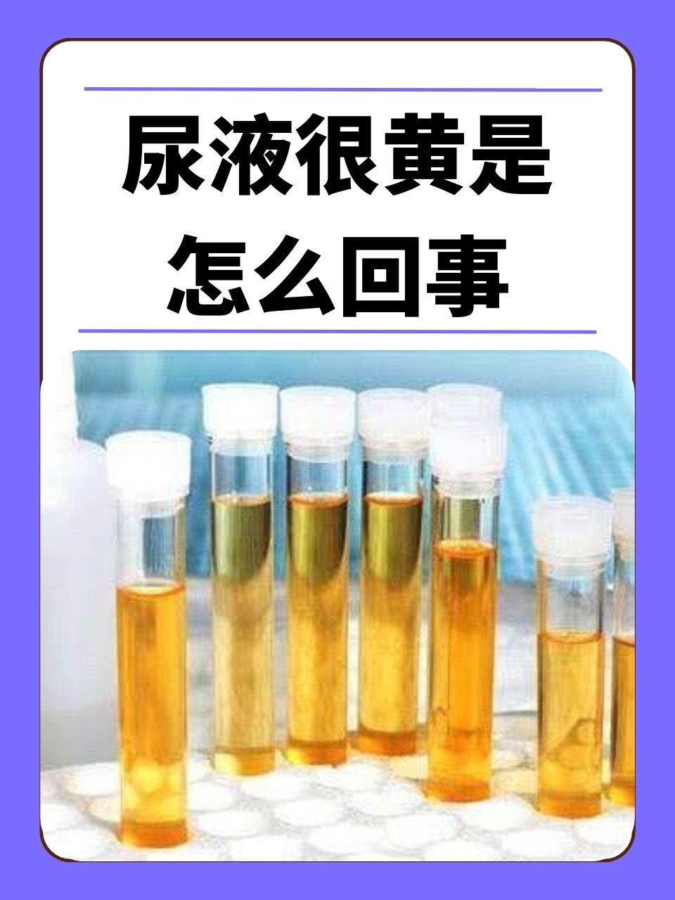 尿深黄图片