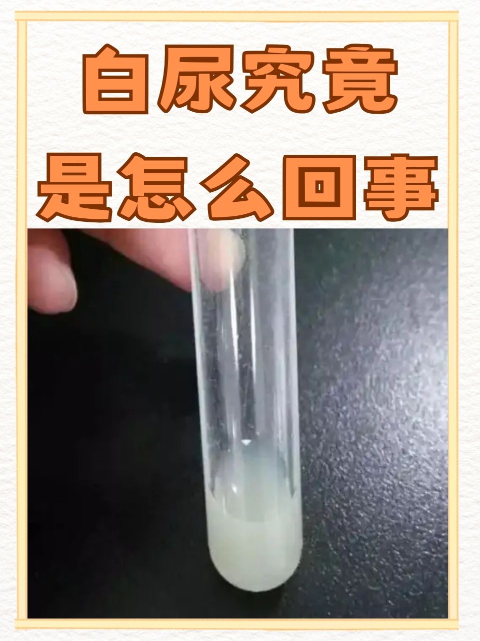 尿液发白浑浊尿浑浊白色沉淀物怎么回事撒尿有刺痛流白色液体12岁男孩