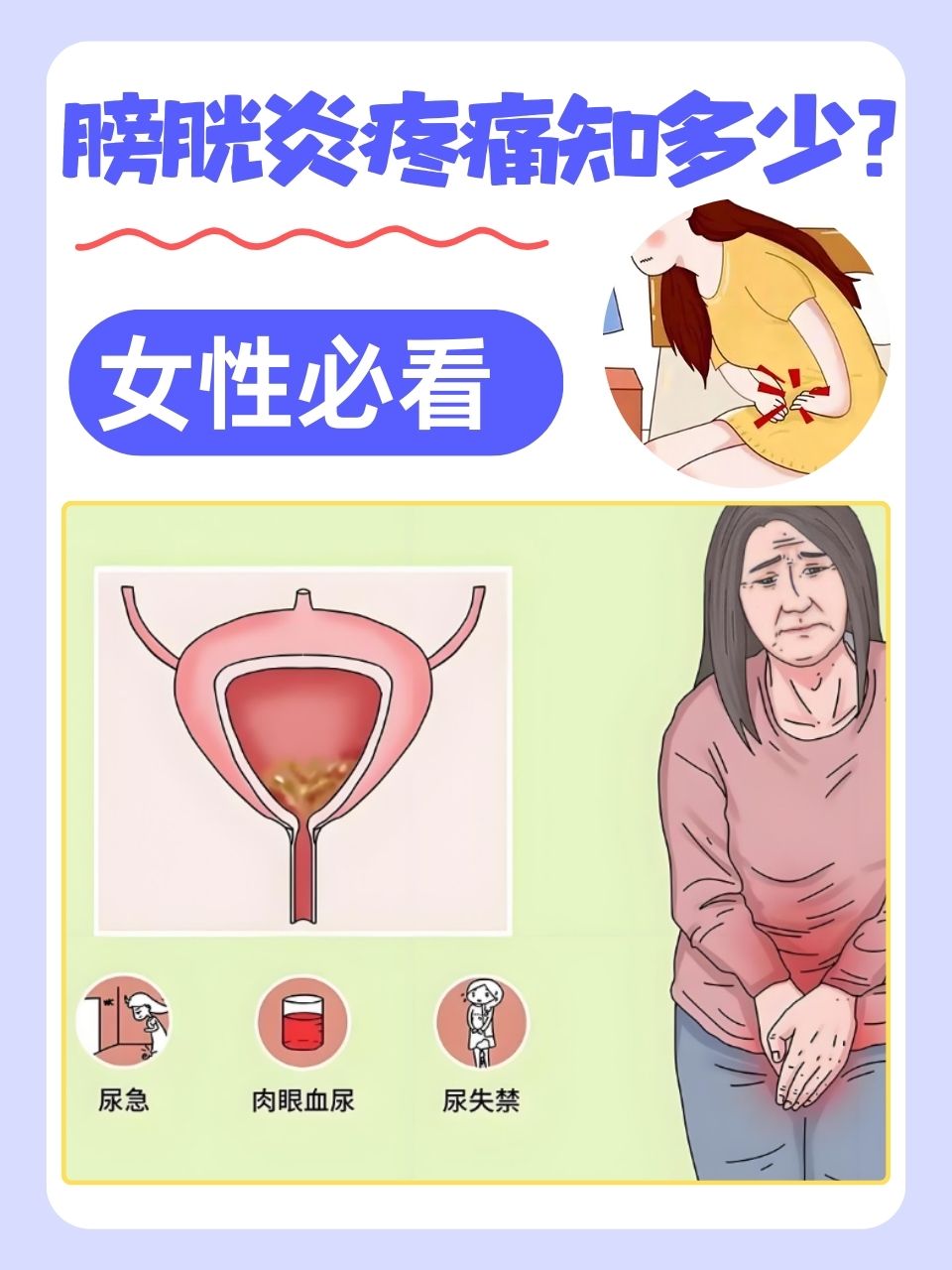 膀胱炎是一种常见的泌尿系统疾病,尤其在女性中更为常见