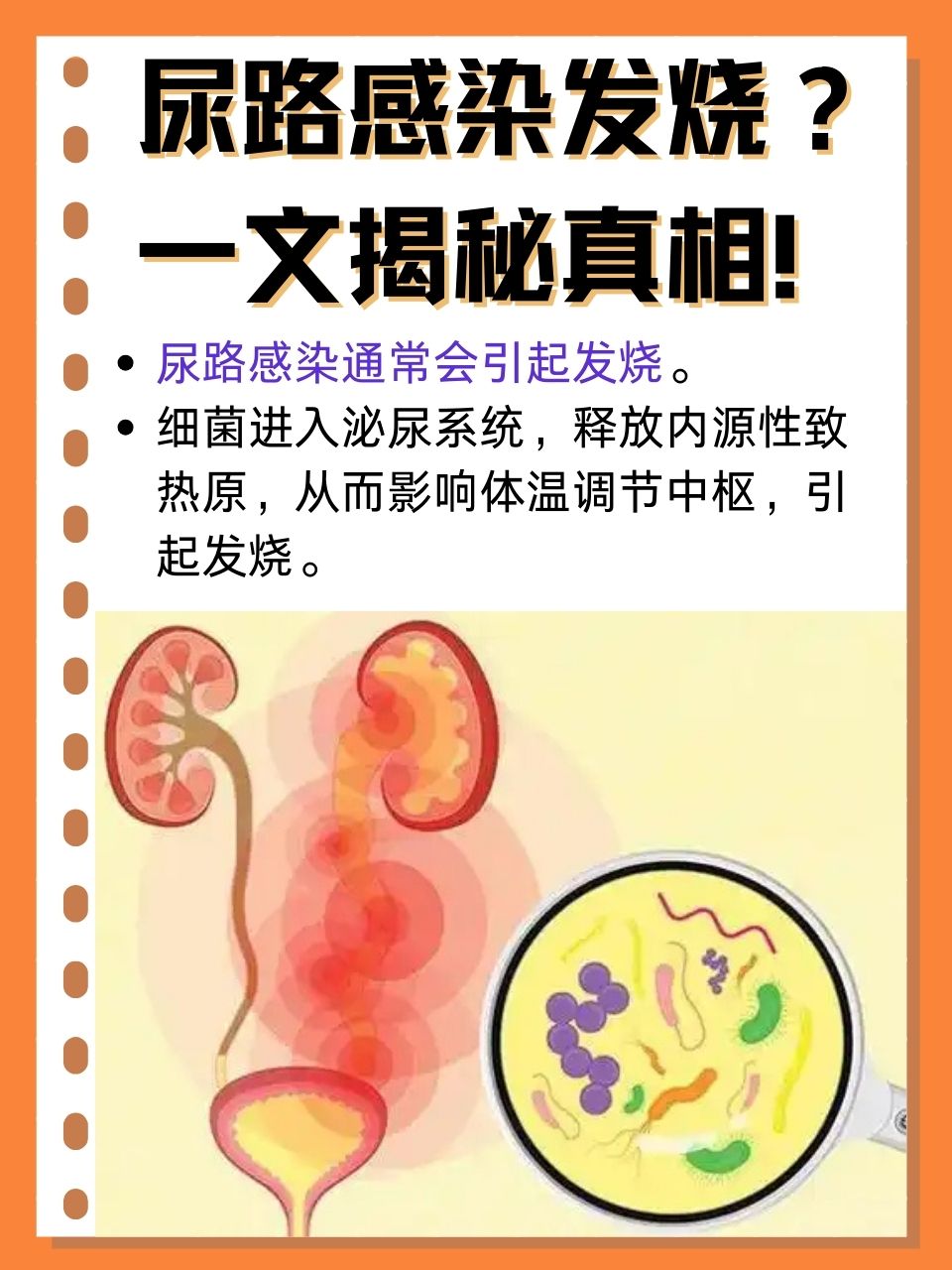 为什么总是尿路感染