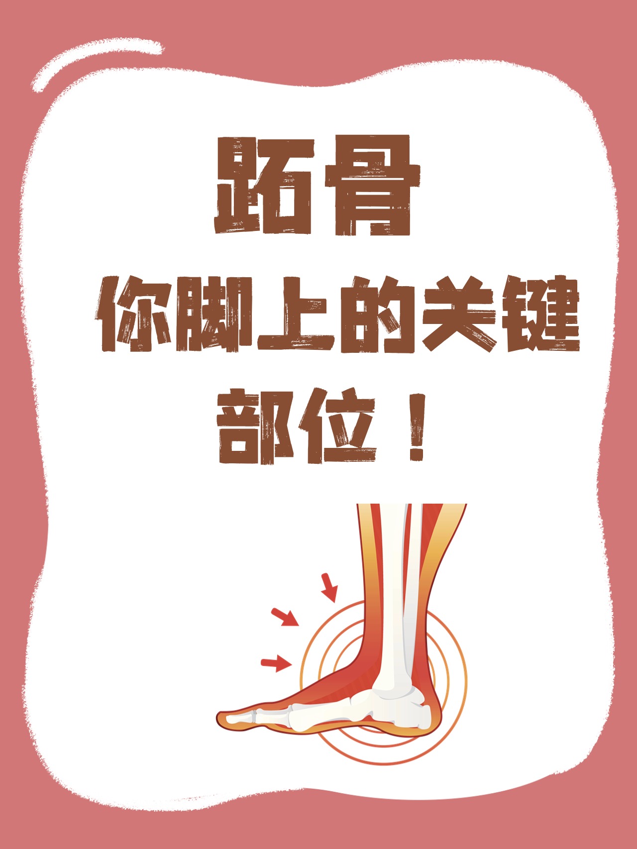 跖骨关节炎了解症状和治疗方法