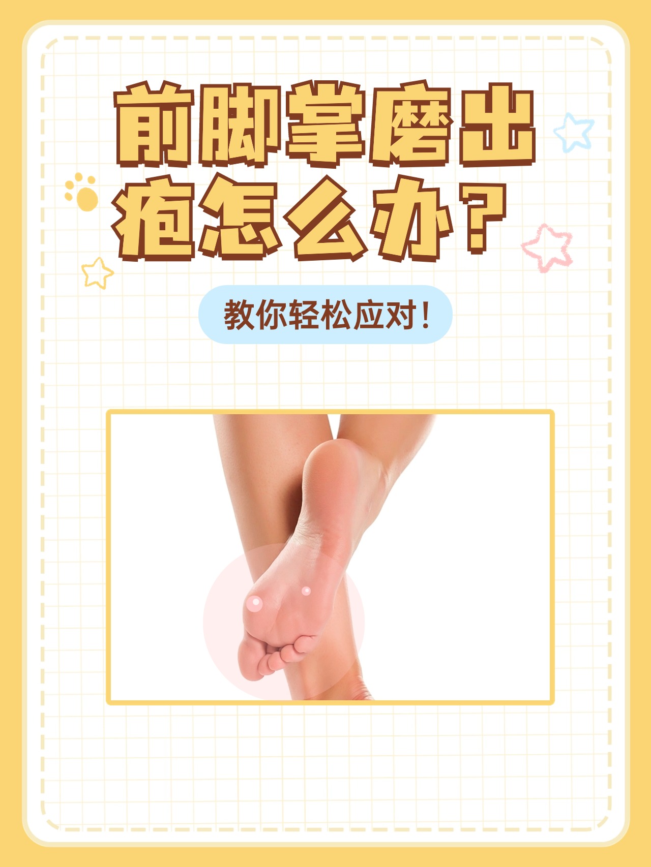 前脚掌磨出疱怎么办?教你轻松应对!