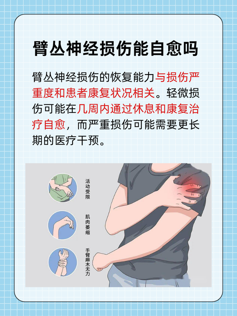 臂丛神经损伤是一种较为严重的神经损伤,其恢复情况受到多种因素酉祆