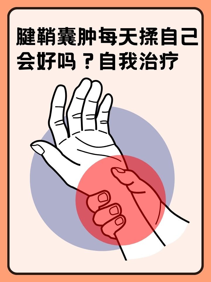 自我治疗  在日常生活中,腱鞘囊肿是一种常见的腕部或足部疾病,它通常