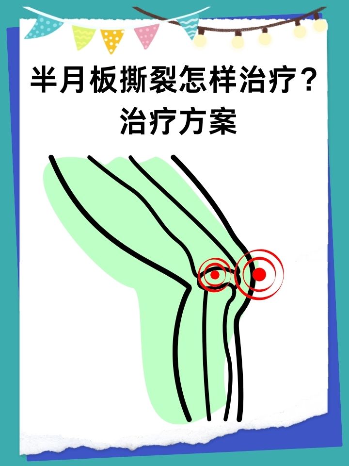 治疗方案  在体育运动或日常生活中,半月板撕裂是一种常见的膝关节