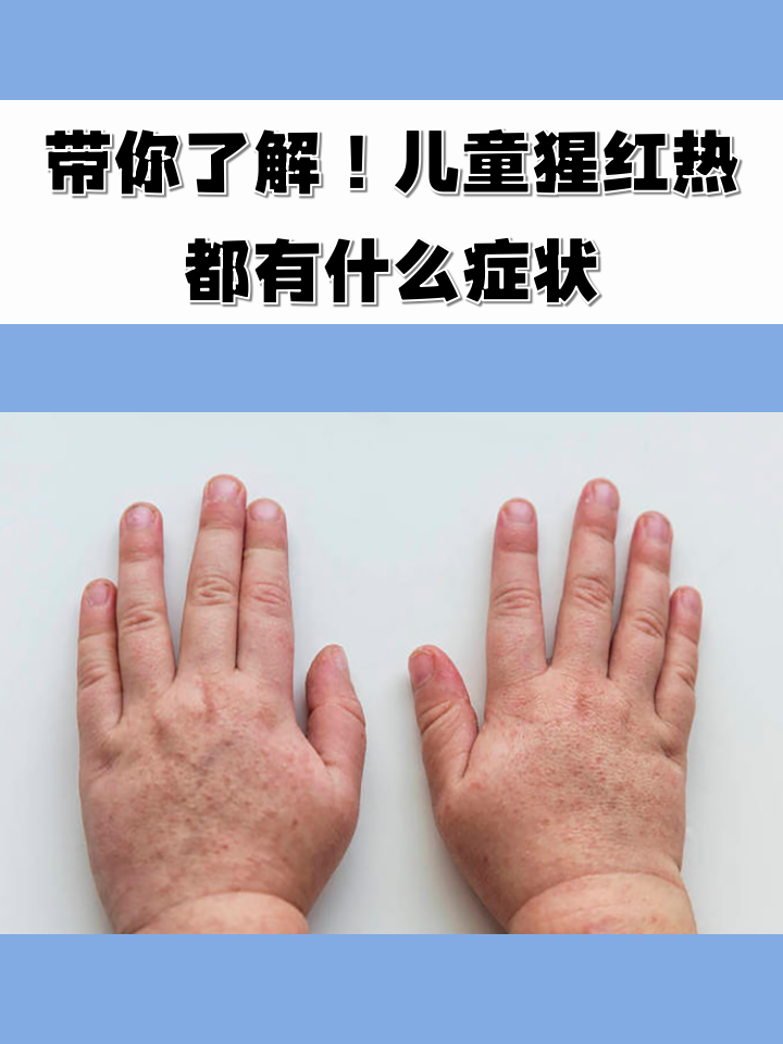 儿童猩红热都有什么症状