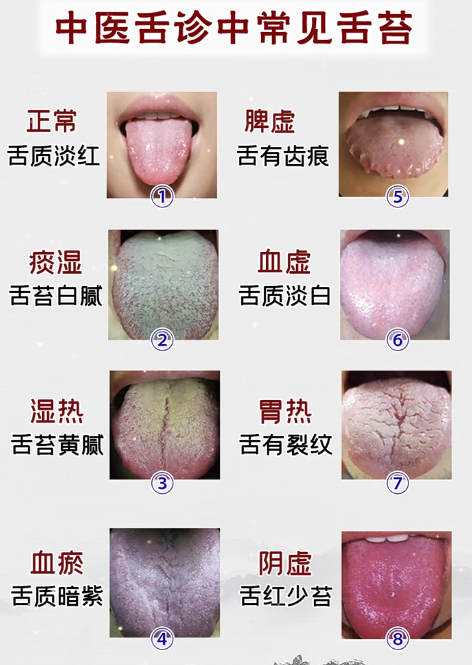 舌苔碧凳嗵ν计唤】档 舌头图片不正常的舌头图片正常人舌头照片
