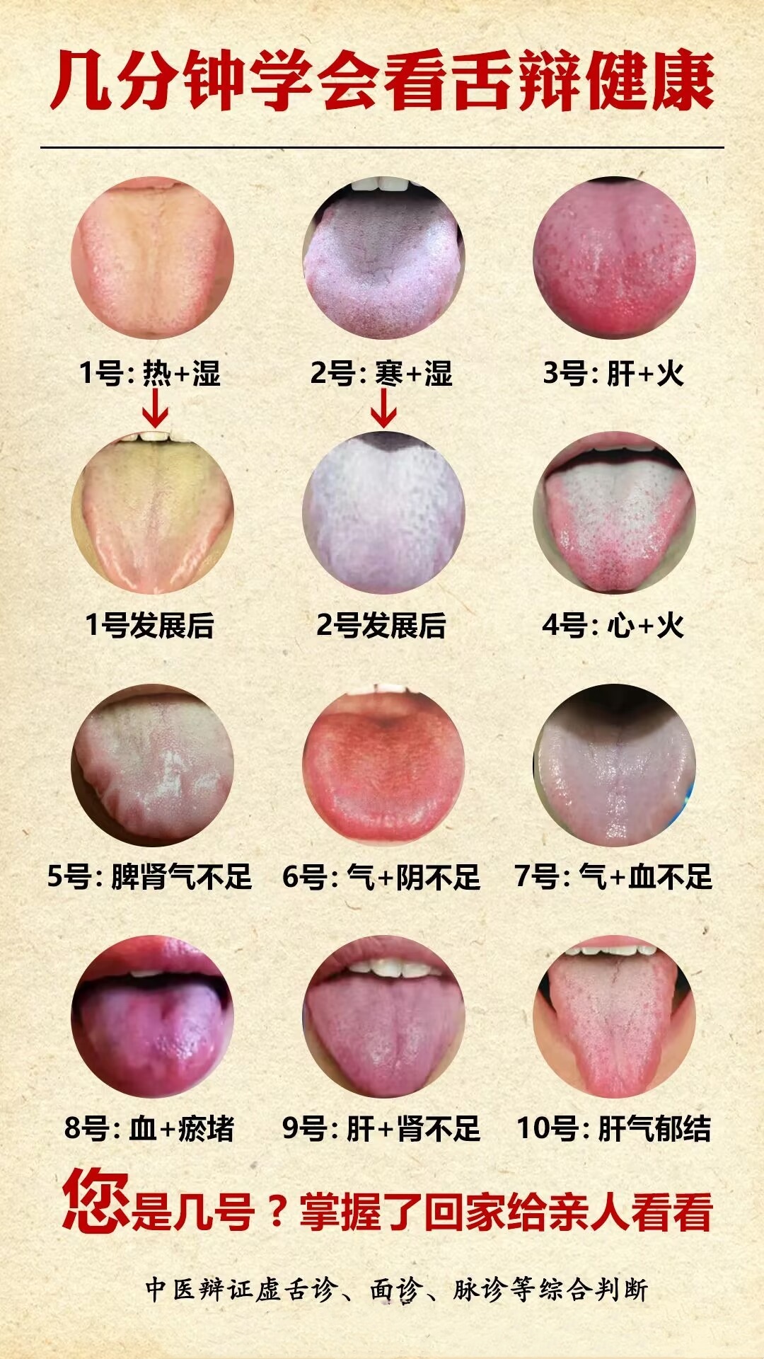 正对舌头中心,避免从上方或下方倾斜拍摄,以免造成舌头形舌象正常舌头