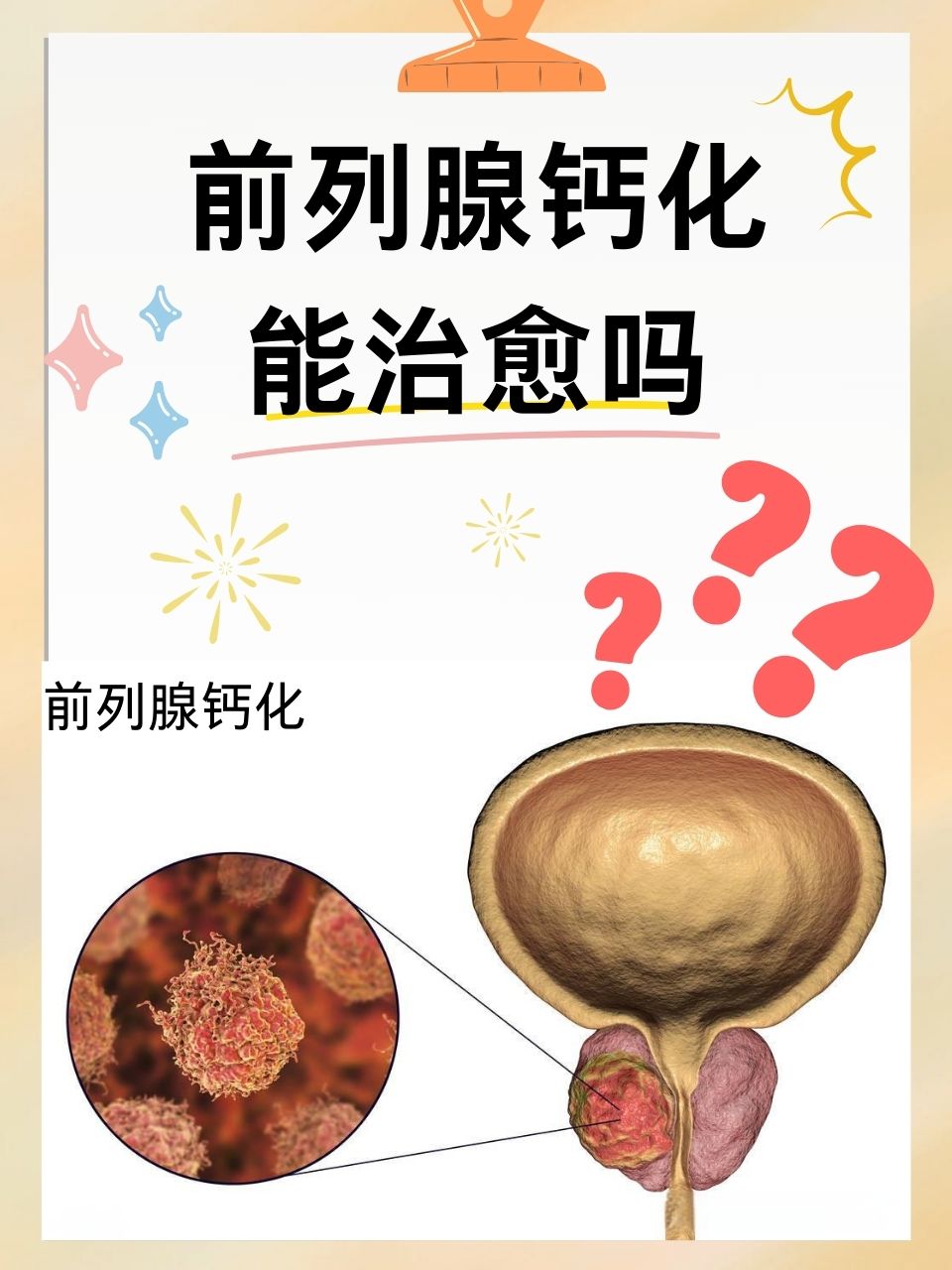 前列腺液细菌培养图片