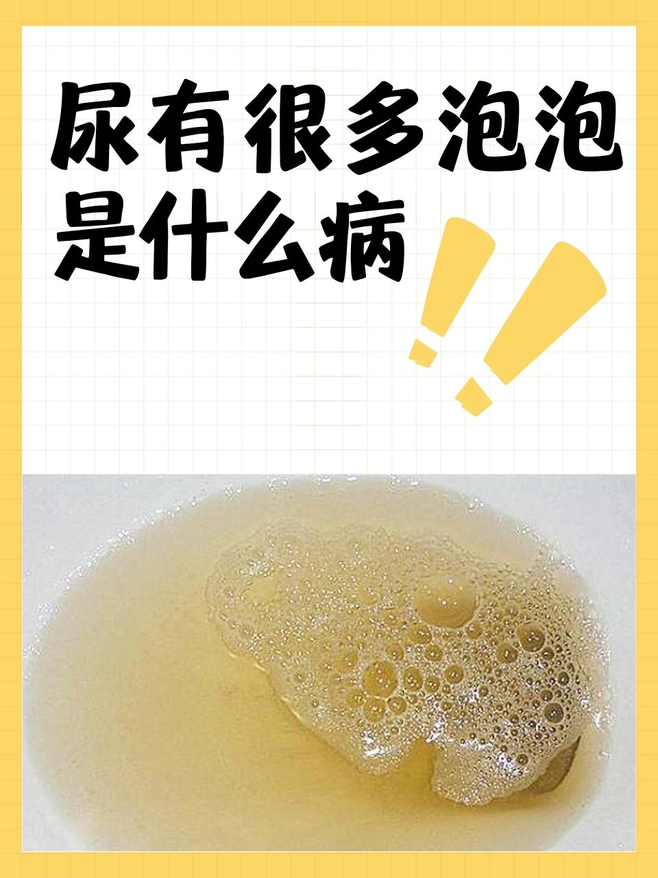 尿液有泡沫正常吗图片