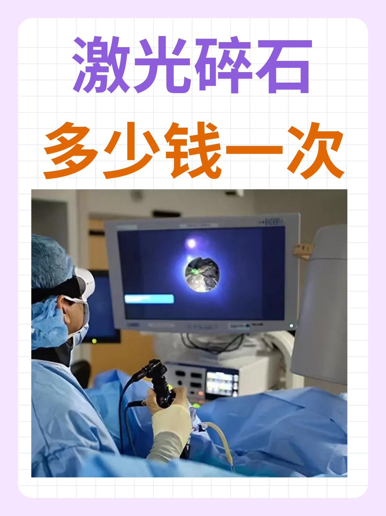激光碎石多少钱一次?