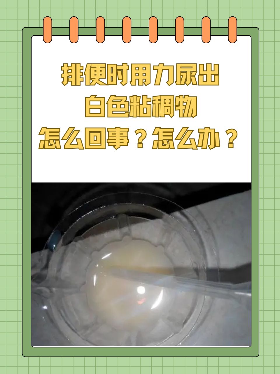 排便时用力尿出白色粘稠物怎么回事?怎么办?