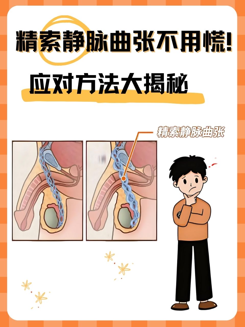 睾丸静脉曲张可能是静脉瓣功能不全,血液回流受阻等原因造成