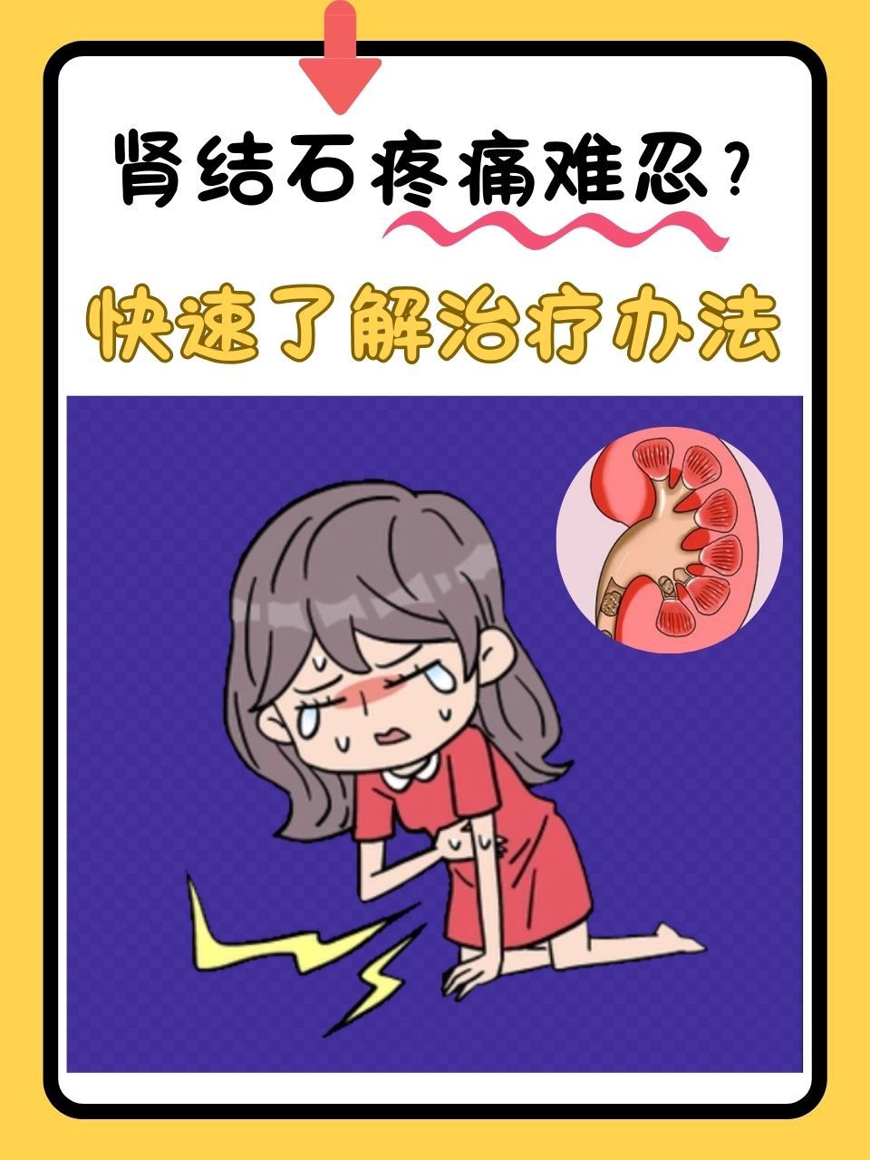 肾结石疼痛难忍?