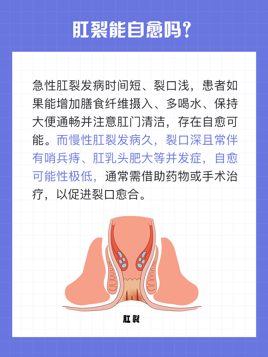为什么肛裂一直好不了 为什么肛裂一直好不了