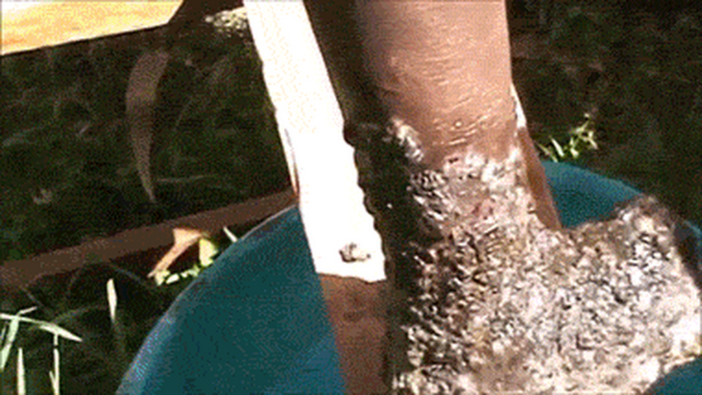 [啊]这个脚还能要吗?[惊哭]据说这是长时间赤脚走沙子路,感染沙蚤了!