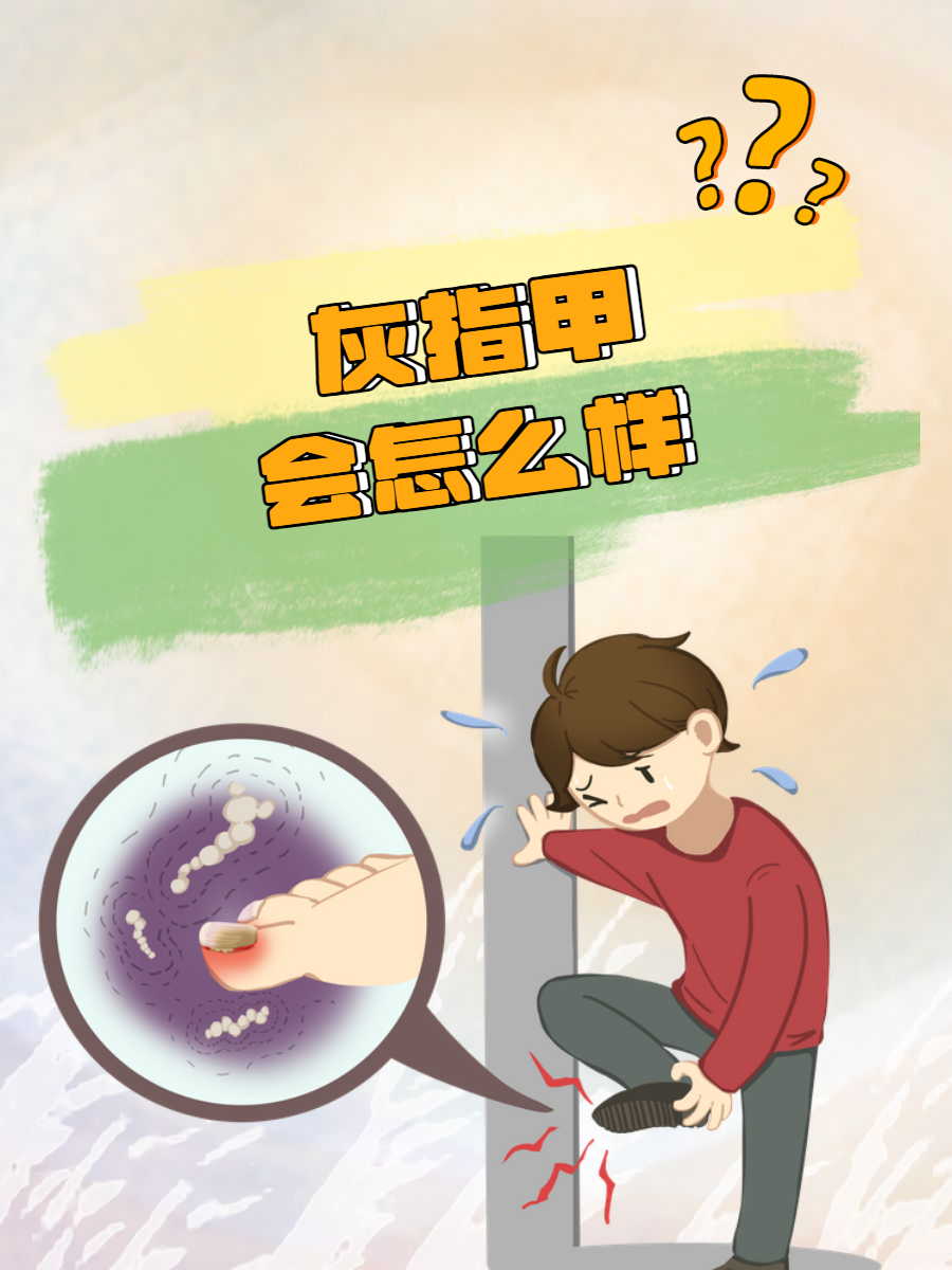 为什么会有指甲