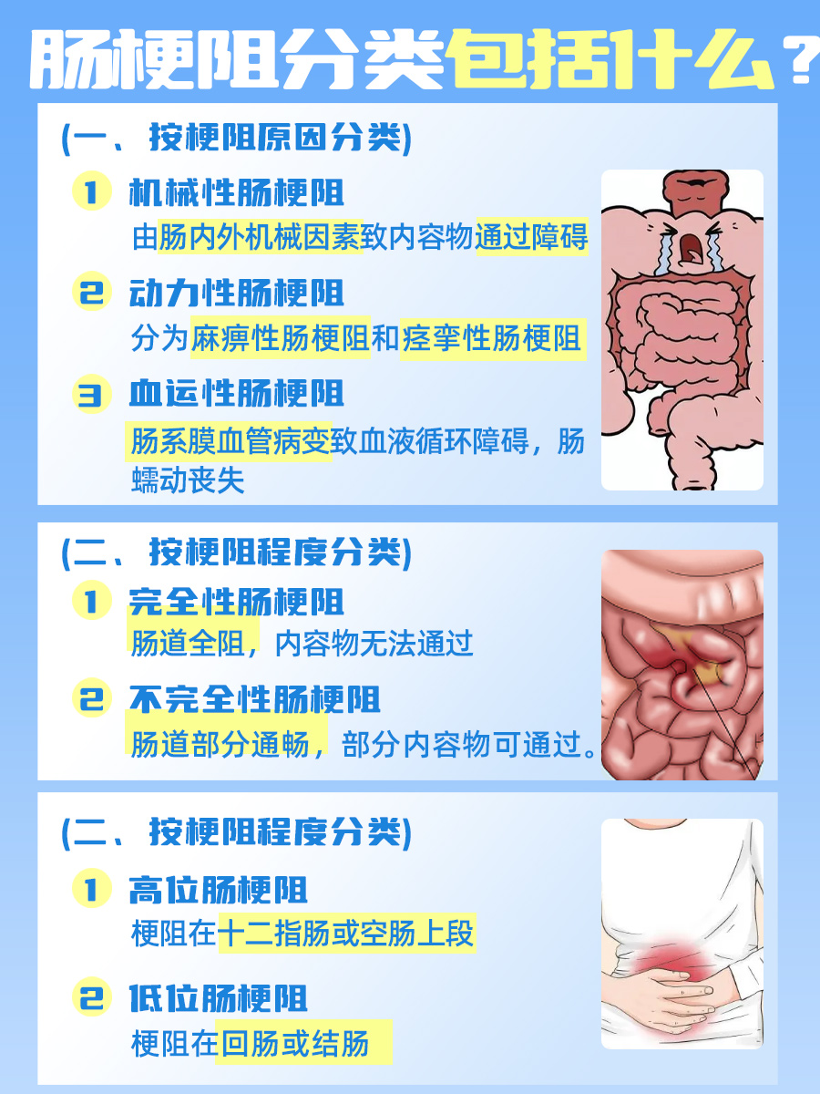 不完全肠梗阻是大病吗