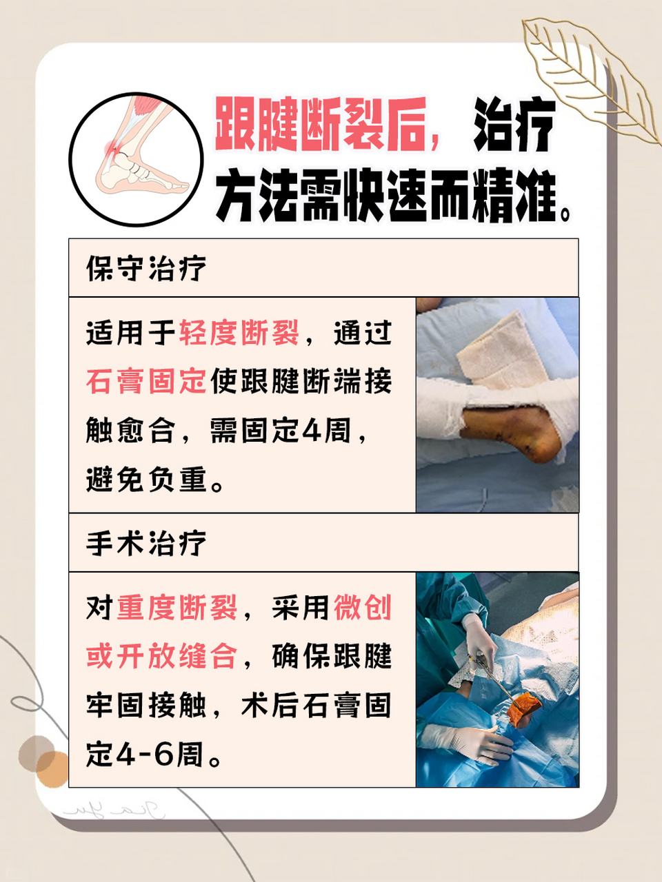 沃尔跟腱图片