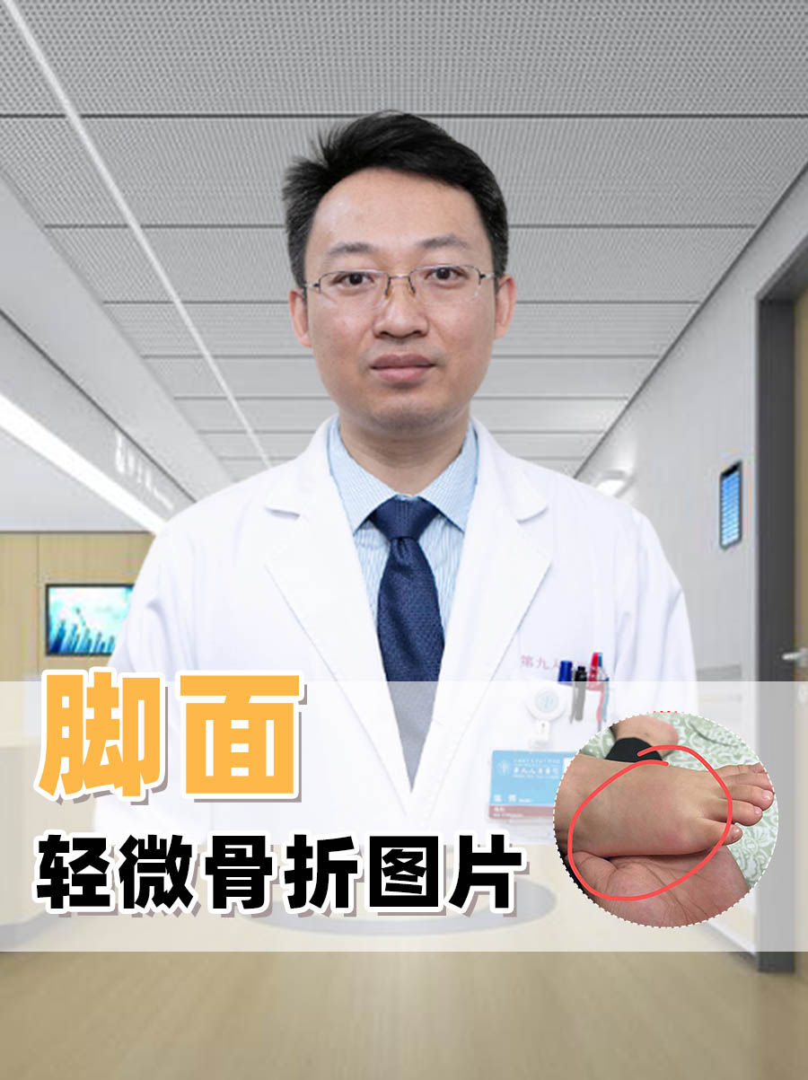 脚面轻微骨折虽然可能不引起严重的疼痛和功能障碍