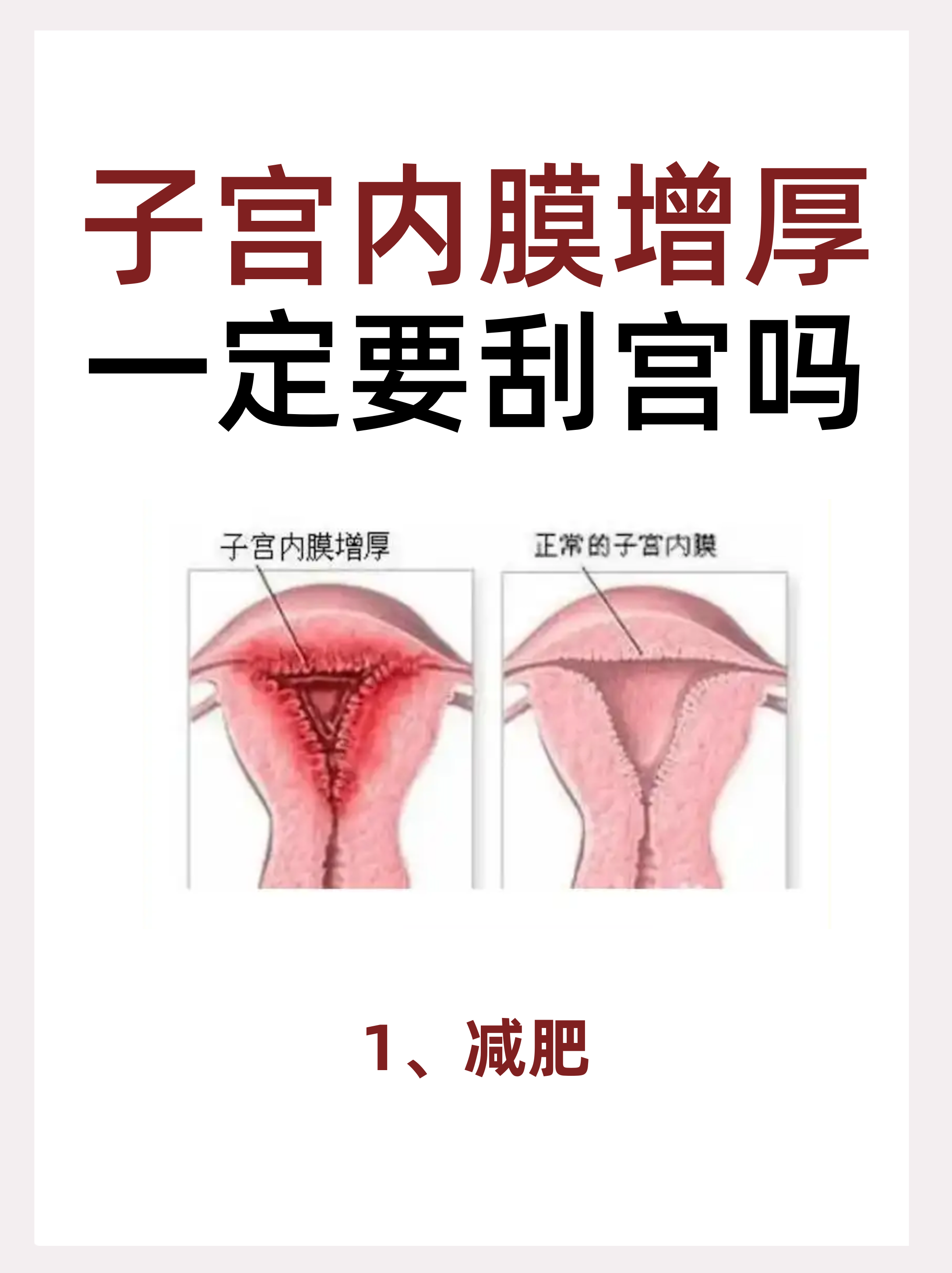 子宫内膜增厚一定要刮宫吗?一篇了解 一,内膜增厚一定要刮宫吗?