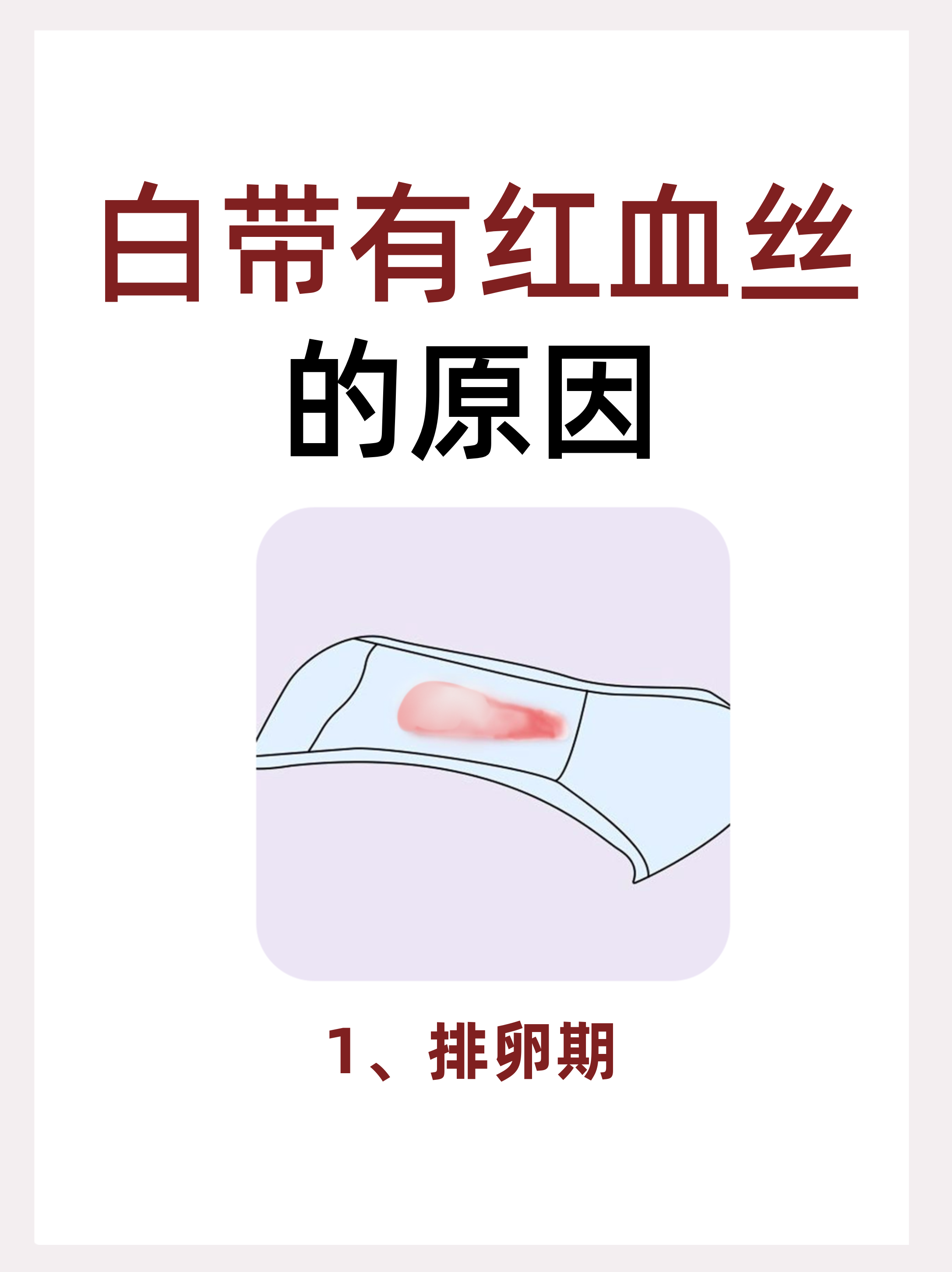 一,生理性原因 1,排卵期出血:在两次月经中间,即排卵期,由于雌妓刎