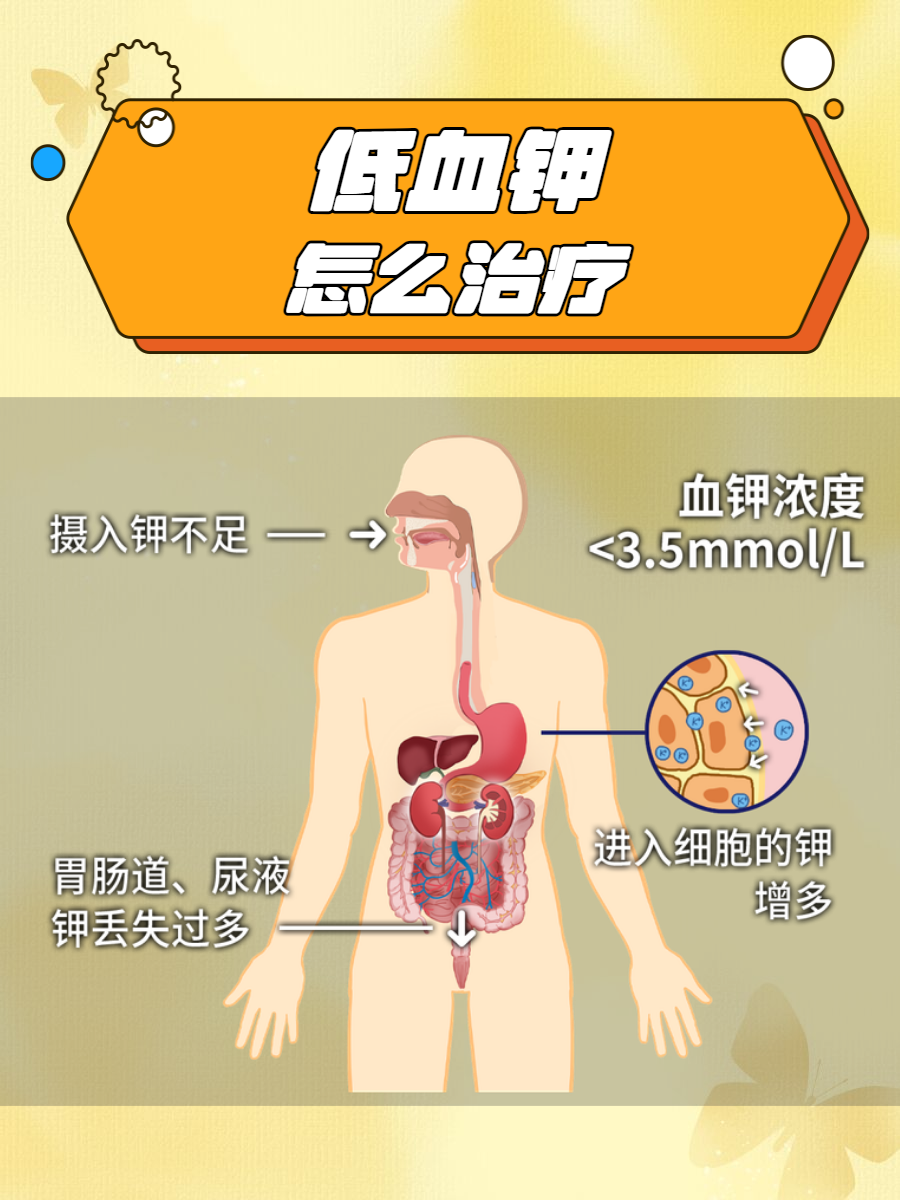 为什么住院打点滴都要补钾