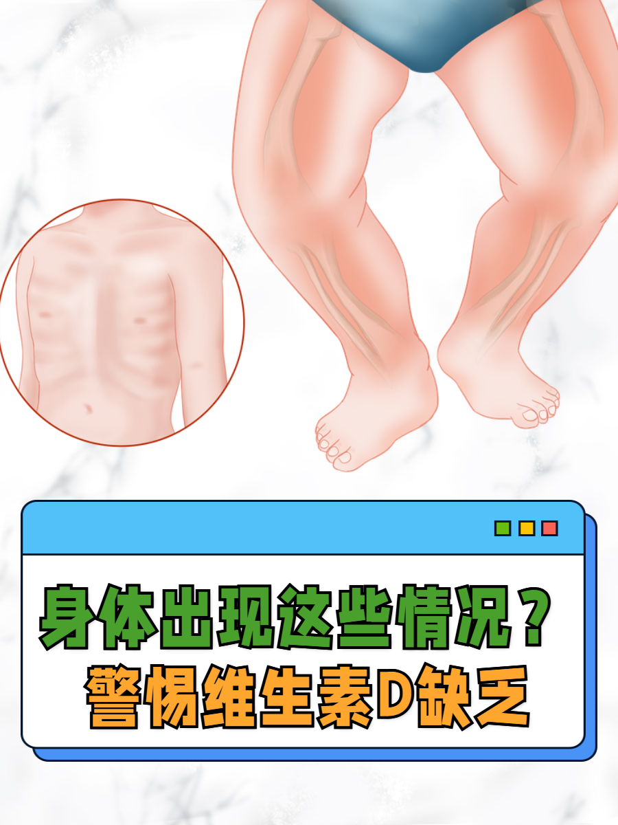 但很多人可能不知道自己缺了它,那维生素d缺乏会有哪些表现呢?