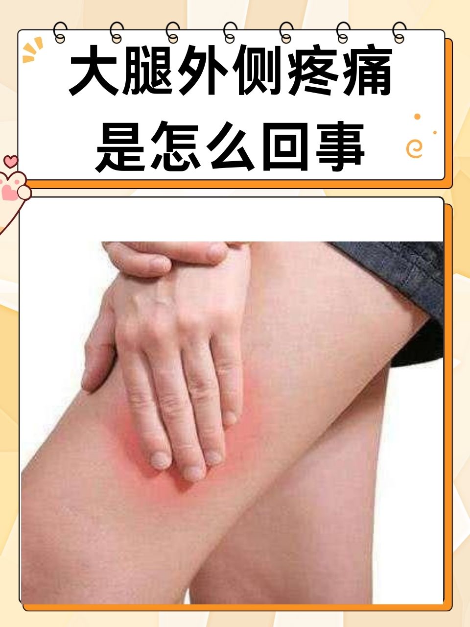 大腿肌腱痛图片