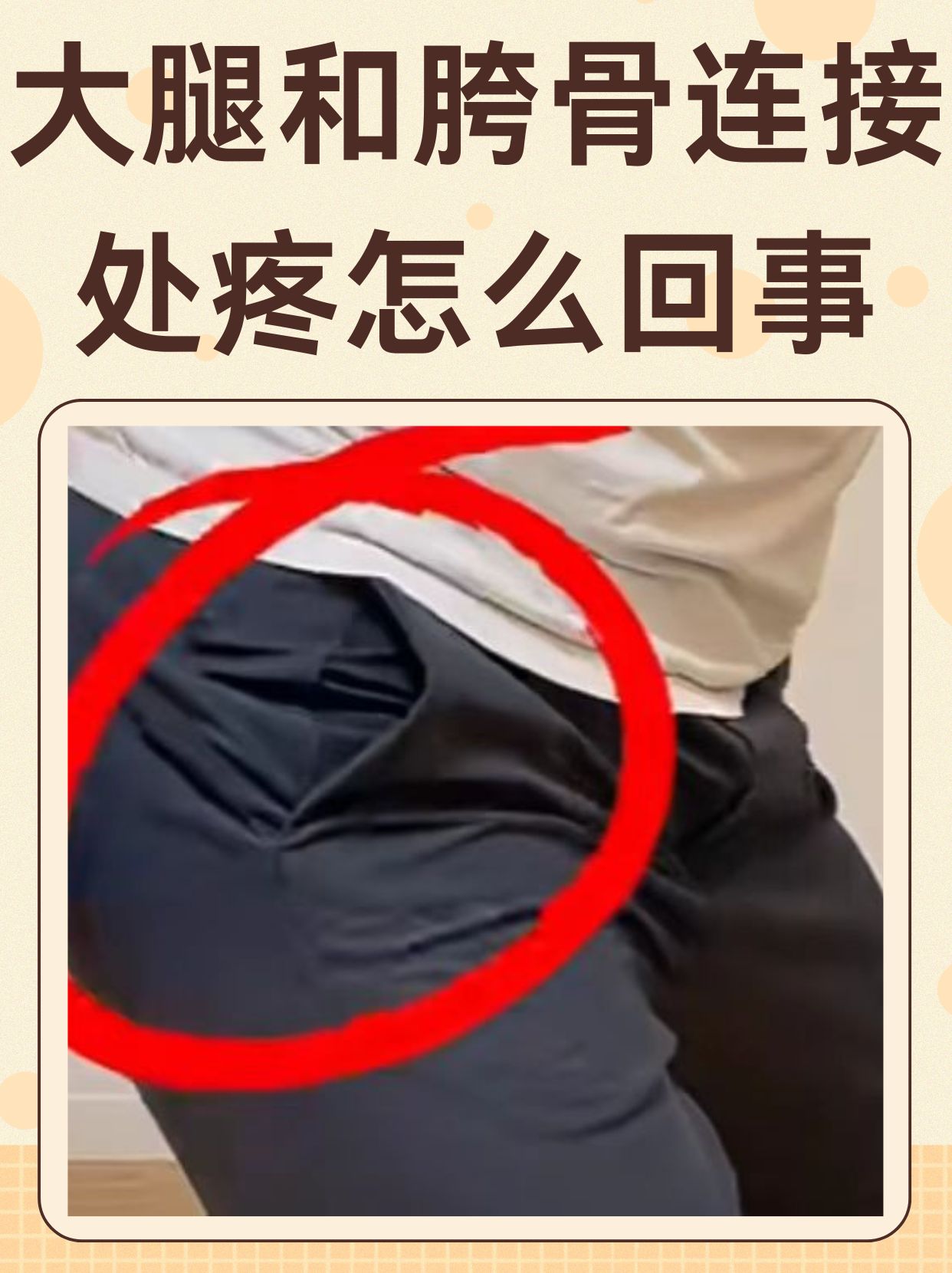 大腿和胯骨连接处疼