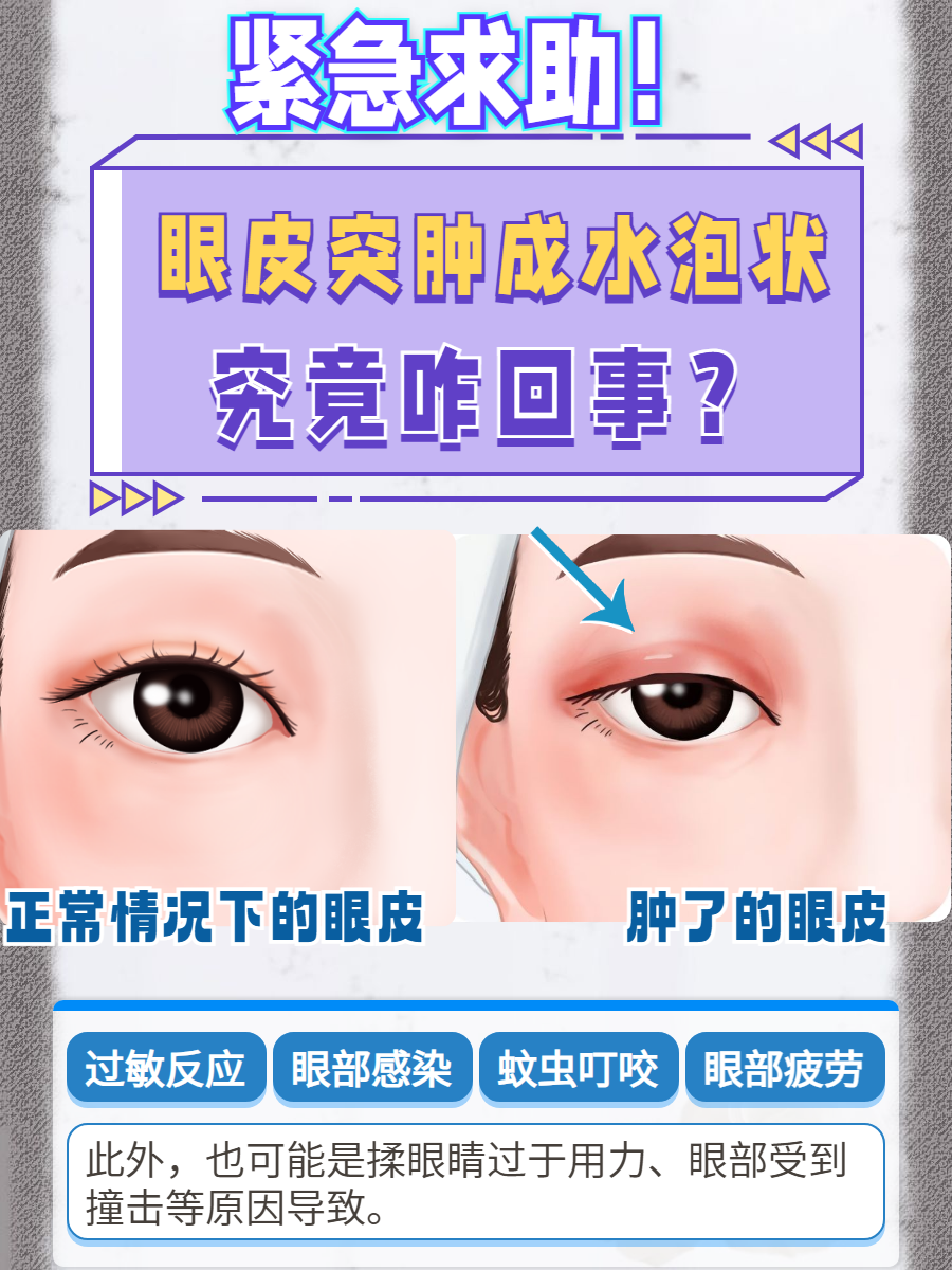 眼睛为什么会肿