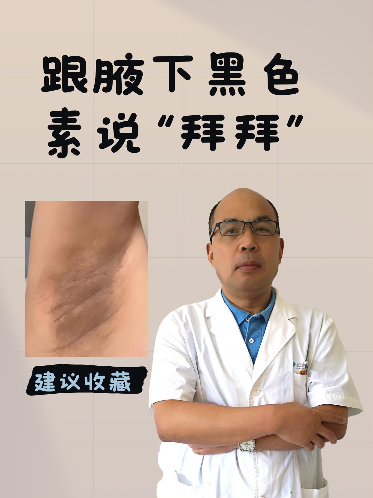 腋下黑色素沉淀图片腋下黑斑癌变早期图片黑棘皮腋下腋下大腿根皮肤