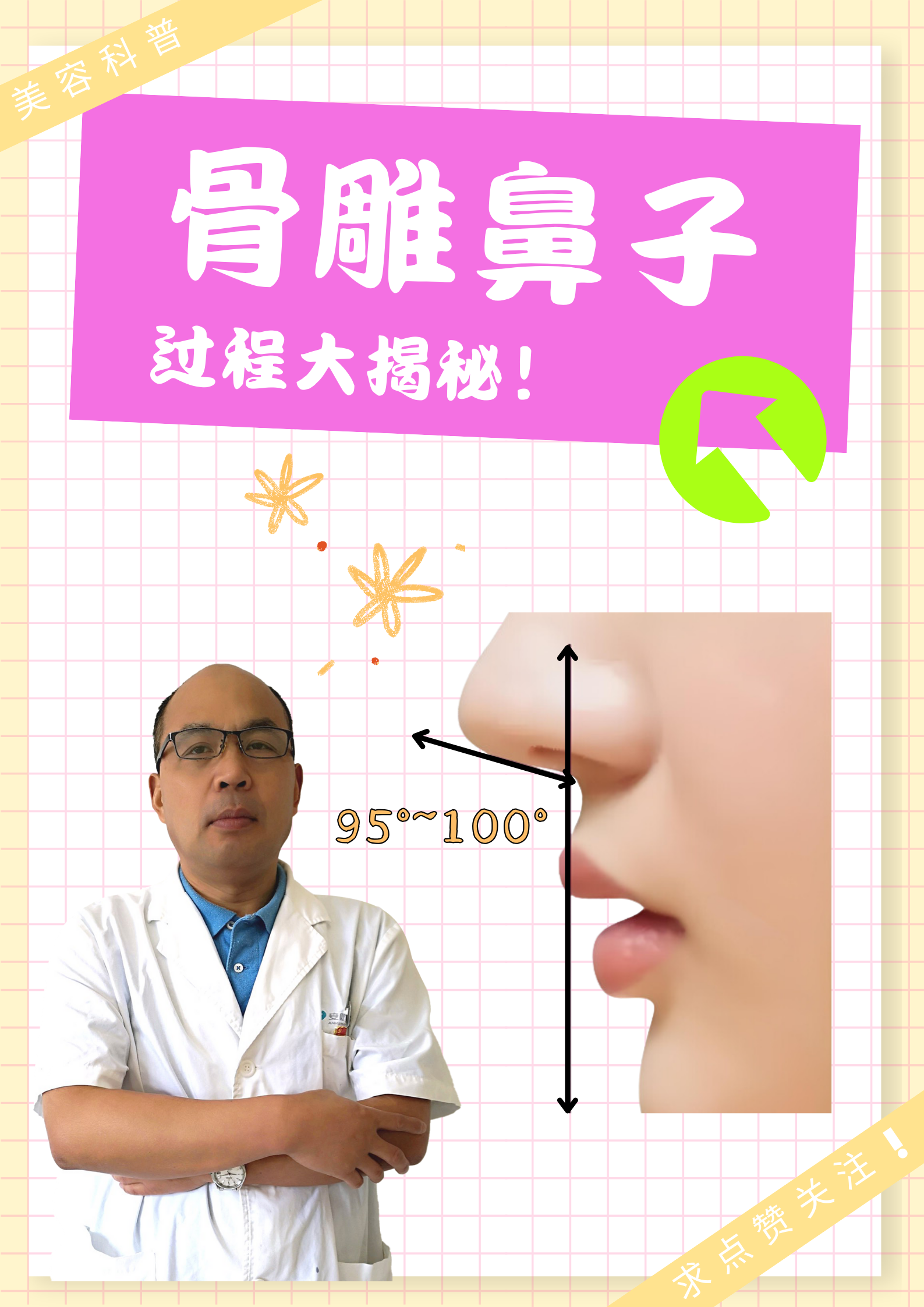 骨雕鼻子是怎么做的 骨雕鼻子是一种利用自体软骨雕塑进行的隆鼻手术