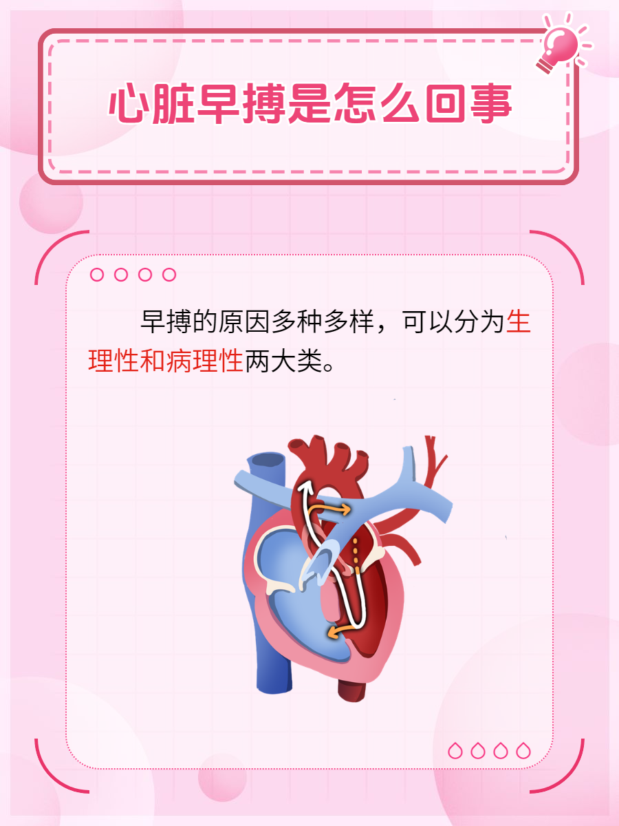 早搏,这个听起来有些专业的词汇,其实与我们的心脏健康息息相关.