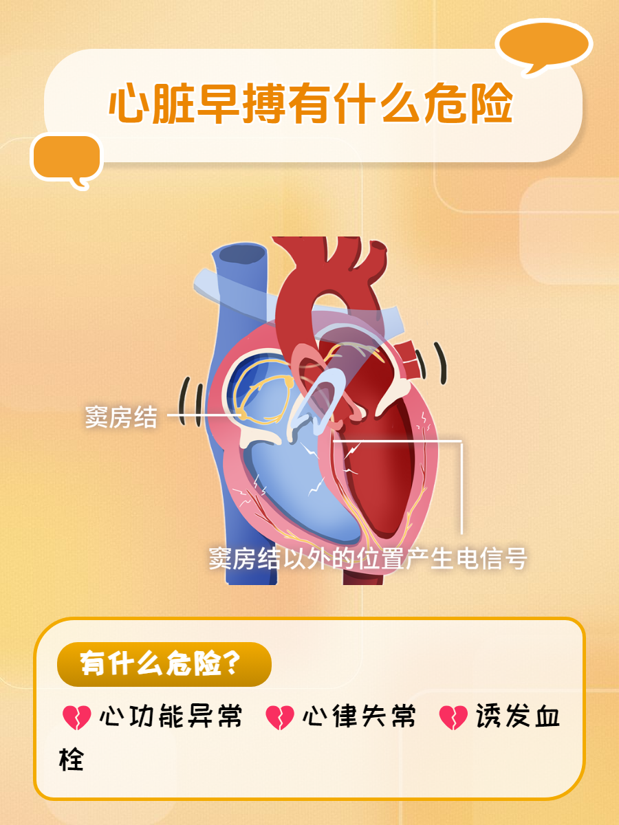 赶紧来了解  很多人听过心脏早搏的这个名词,但对于这个名词并不是