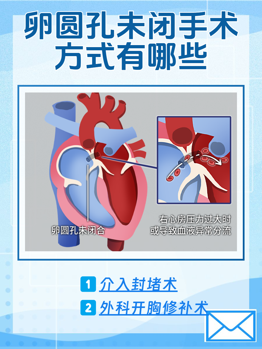 卵圆孔未闭手术图片