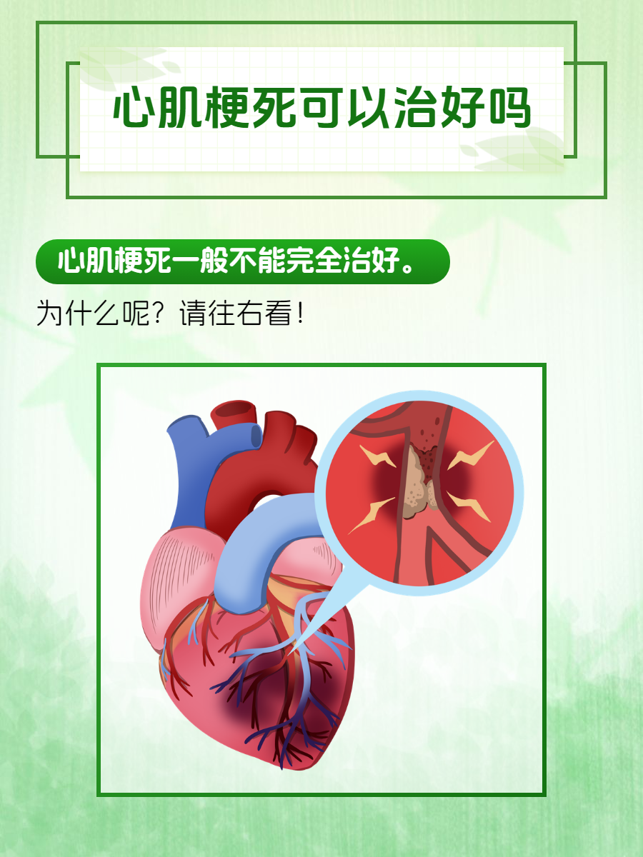为什么会心梗有前兆的吗为什么在线